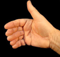 Daumenspitze - Vernet - Sechster Finger